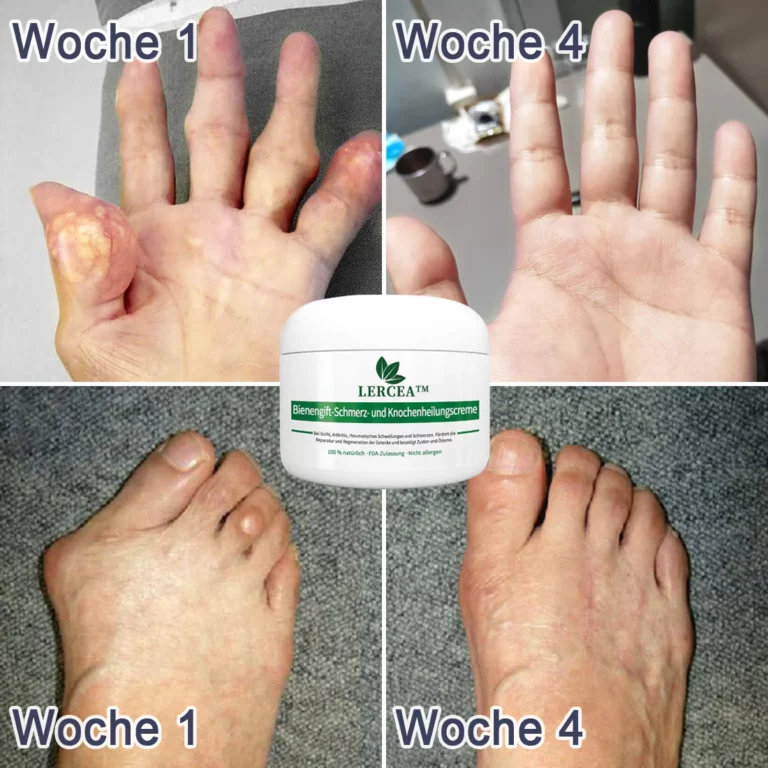 LERCEA™ Bienengift Schmerz- und Knochenheilung