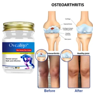 Oveallgo™ Bee Venom Joint & Bone Pain Healing Cream