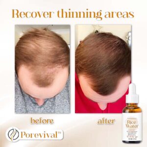 Porevival™ Natural Hair Growth Serum