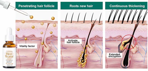 Porevival™ Natural Hair Growth Serum