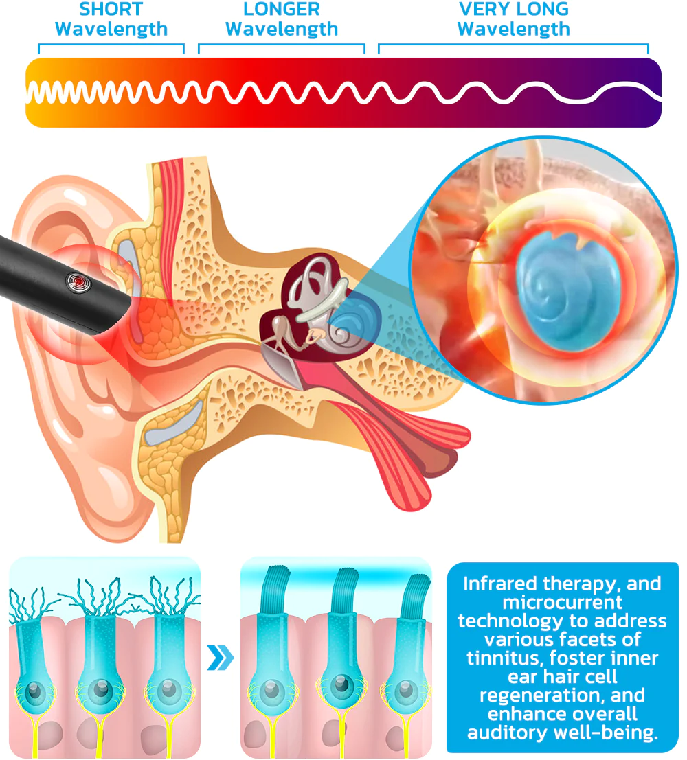 RICPIND Tinnitus NerveTreat InfraredThermal Pen
