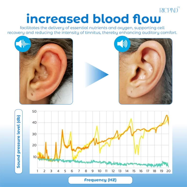 RICPIND Tinnitus NerveTreat InfraredThermal Pen