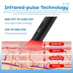 RICPIND Tinnitus NerveTreat InfraredThermal Pen