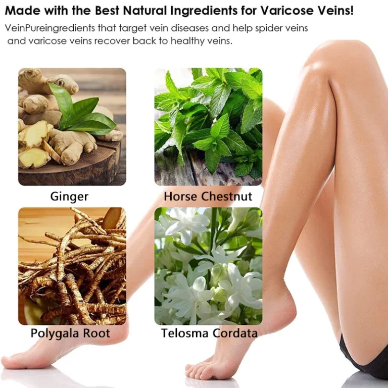 Seurico™ Varicose Veins Gel