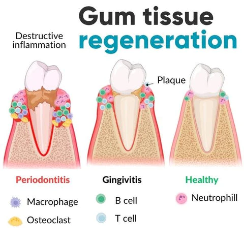 TLOPA™ Gum Shield Therapy Gel