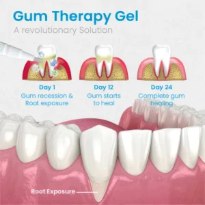 UNPREE™ Gum Shield Therapy Gel