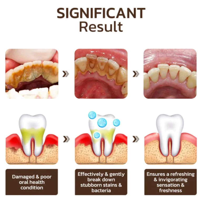 UNPREE™ Niacinamide Whitening Toothpaste