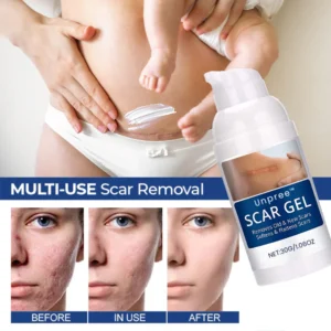 UNPREE™ Silicone Scar Removal Gel