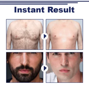 Unpree™ GentsThing Face & Body Hair Removal Cream