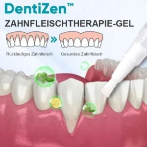 Yagoo™ Zahnfleischtherapie-Gel