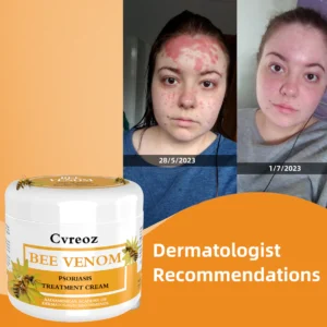 Cvreoz Bee Venom Psoriasis Treatment Cream