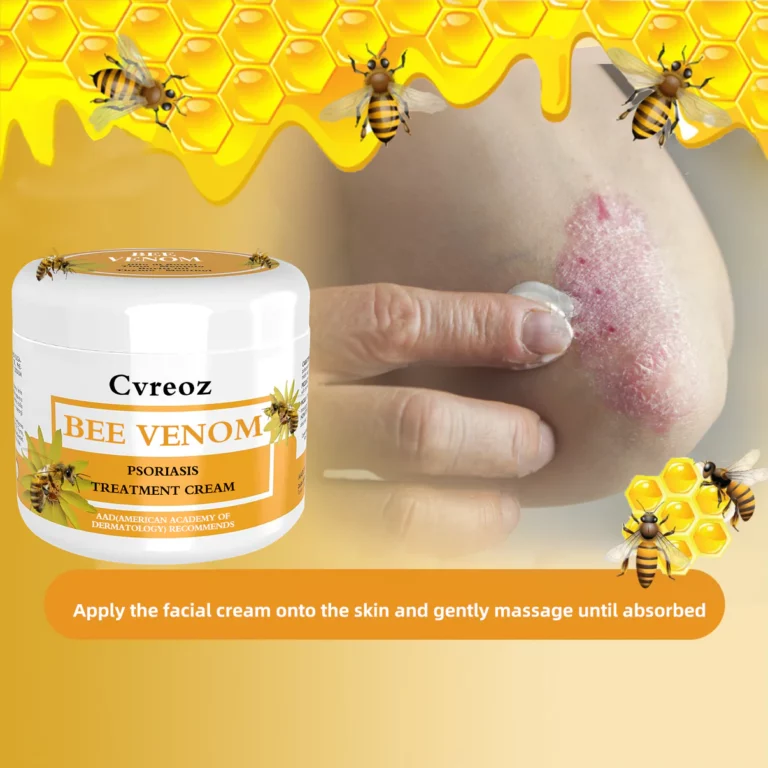 Cvreoz Bee Venom Psoriasis Treatment Cream