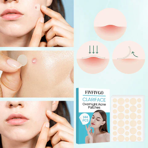 Fivfivgo™ ClariFace Overnight Acne Patches