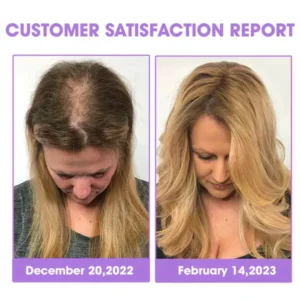 Oveallgo™ Hair Follicle Repair Hair Growth Drops - Achieve thicker hair quickly