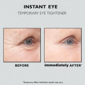 Instant Eye Temporary Eye Tightener