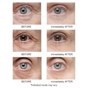 Instant Eye Temporary Eye Tightener