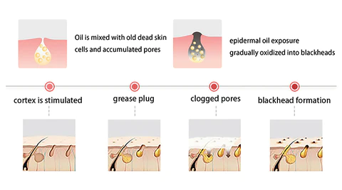 LIMETOW™ Hydrocolloid Blackhead Strips