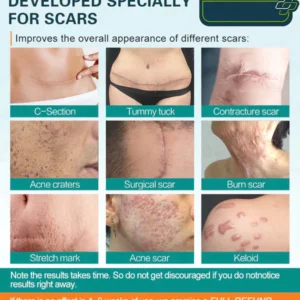 LOVILDS™ Advanced Scar Spray For All Types of Scars