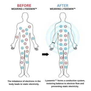 Lyseemin™ Antistatisches Elektrizitätsarmband