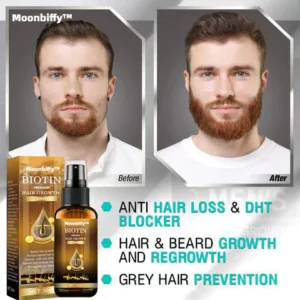 Moonbiffy™ Biotin Premium Hair Growth Serum