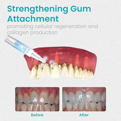 NESLEMY™ Gum Shield Therapy Gel