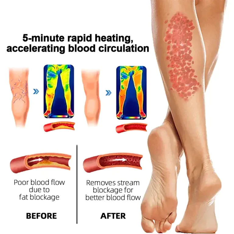 NESLEMY™ Radiofrequency Herbal Thermal Knee Support