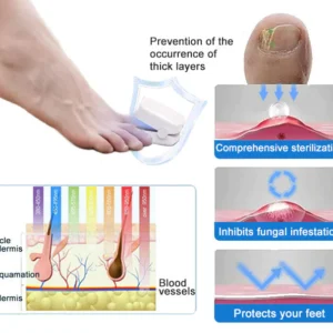 Ourlyard™ Efficient Light Therapy Device for the Treatment of Nail Disorders