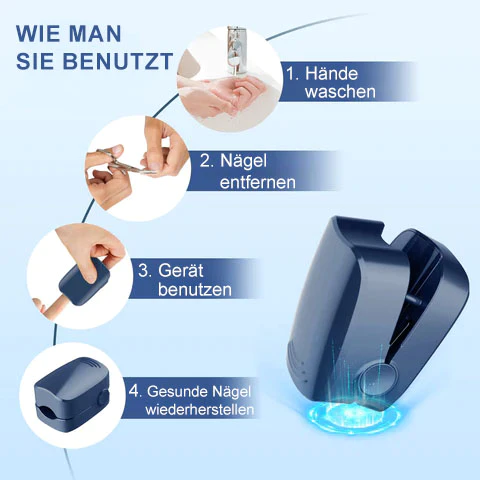 Ourlyard™ Effizientes Lichttherapiegerät zur Behandlung von Nagelerkrankungen