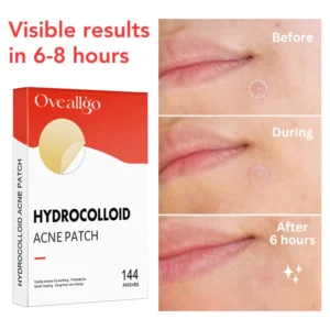 Oveallgo™ Nighttime Acne Patch