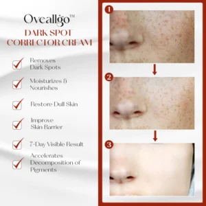 Oveallgo™ ProX Dark Spot Corrector Cream