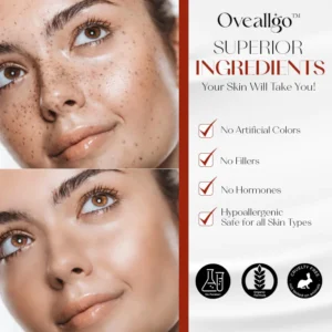 Oveallgo™ ProX Dark Spot Corrector Cream