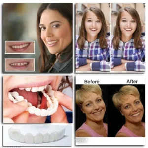 Oveallgo™ SMILE Adjustable Snap-On Dentures