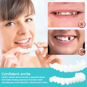 Oveallgo™ SMILE Adjustable Snap-On Dentures