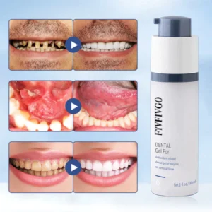 Oveallgo™ Teeth Whitening Repair Regrowth Dental Gel