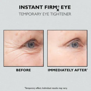 PuffLess™ Temporary Eye Tightener