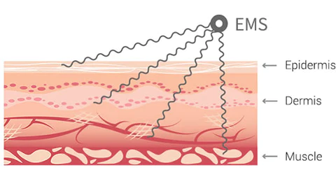 RICPIND ButtUp Cellu MicroCurrent Conductive Device