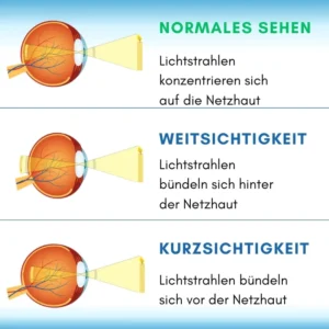 VisioClear™ Flüssige Tageslinse