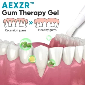 AEXZR™ Gum Therapy Gel