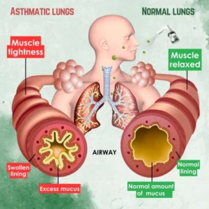 AEXZR™ Lung Care Spray