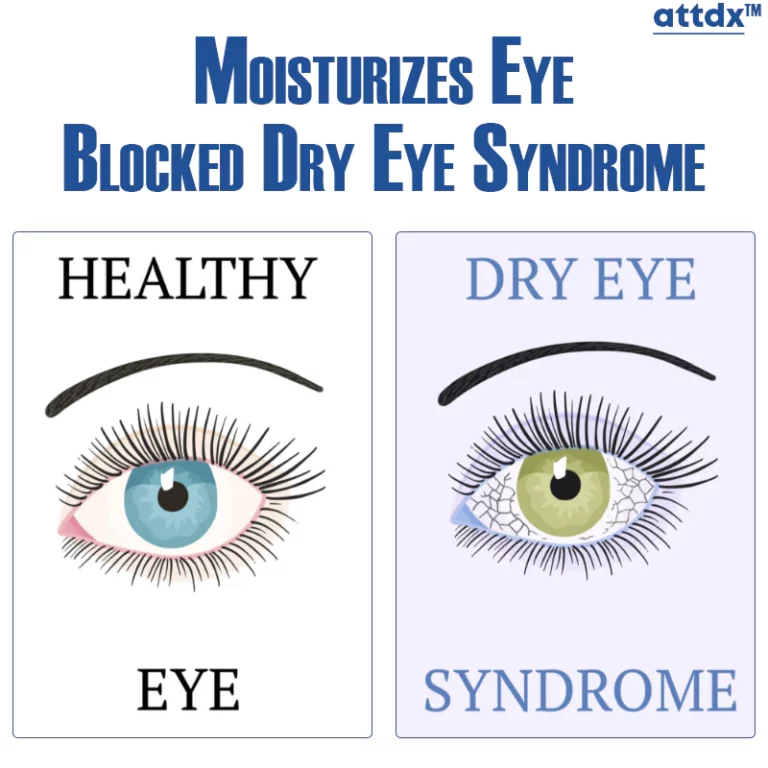 ATTDX Clear Sight Treatment Reversal Eye Drops