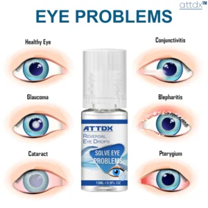 ATTDX Eye Problem Treatment Reversal Eye Drops