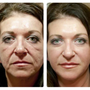 ATTDX SolubleCollagen AntiAging Mask