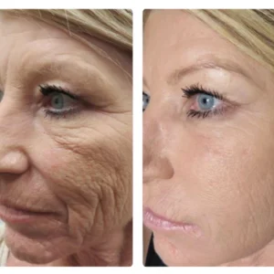 ATTDX SolubleCollagen AntiAging Mask