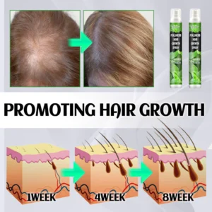 Awzlove™ FolliHerb Hair Growth Spray