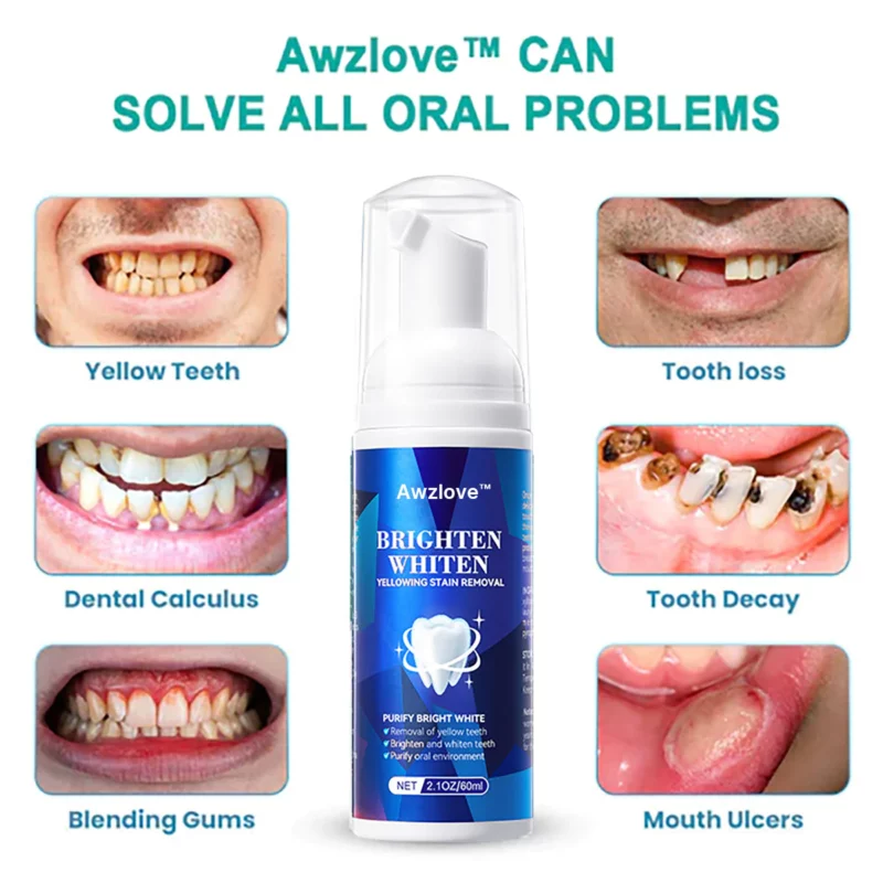 Awzlove™ White Teeth Total Care Mouthwash