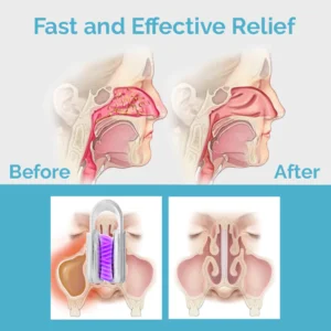 Ceoerty™ MucusRelief Nasal Cleansing Device