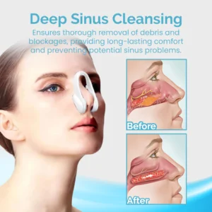 Ceoerty™ MucusRelief Nasal Cleansing Device