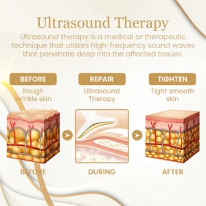 Ceoerty™ RevitaSculpt Ultrasonic Facelift Device