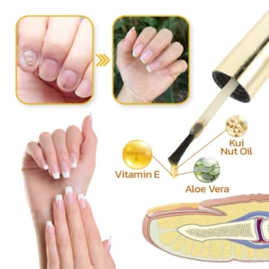 LIMETOW™ Peeling Nail Serum