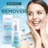 Lanthome™ Dark Spot Remover